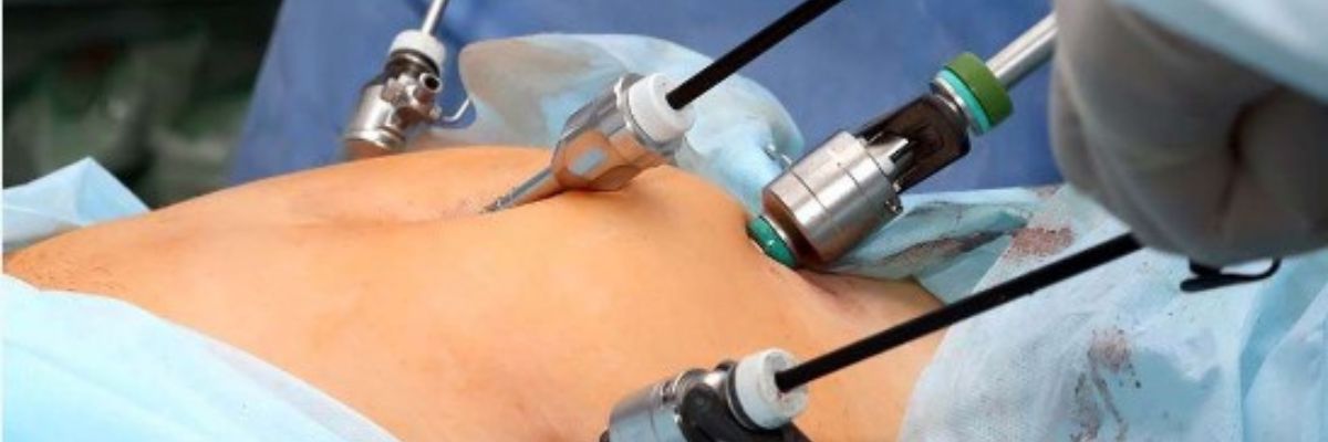 General and laparoscopic surgery services by CurePath Health Solution, offering specialized surgical care and minimally invasive treatment options for various general surgical conditions.